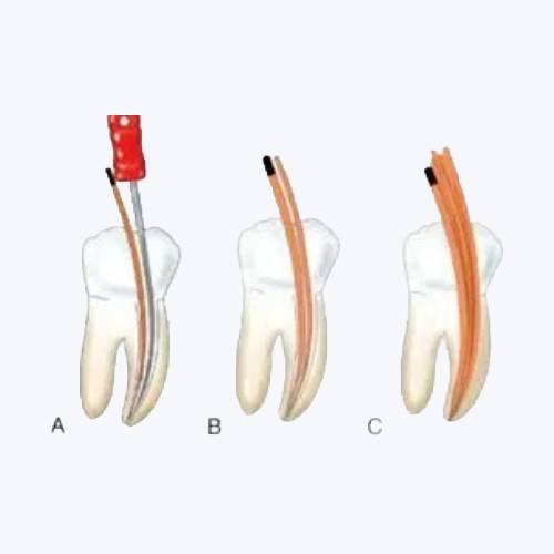 Diadent Pro T Paper Points
